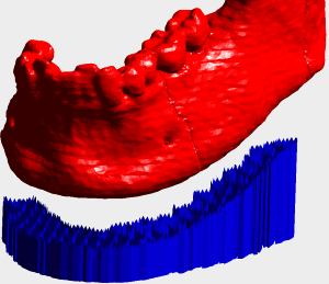 support structure for lower jaw